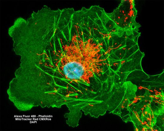 ZEISS Microscopy Online Campus | Fluorescence Image Gallery