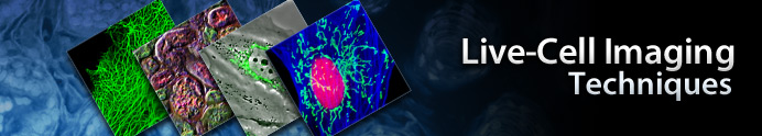 Microscopy Techniques for Live-Cell Imaging
